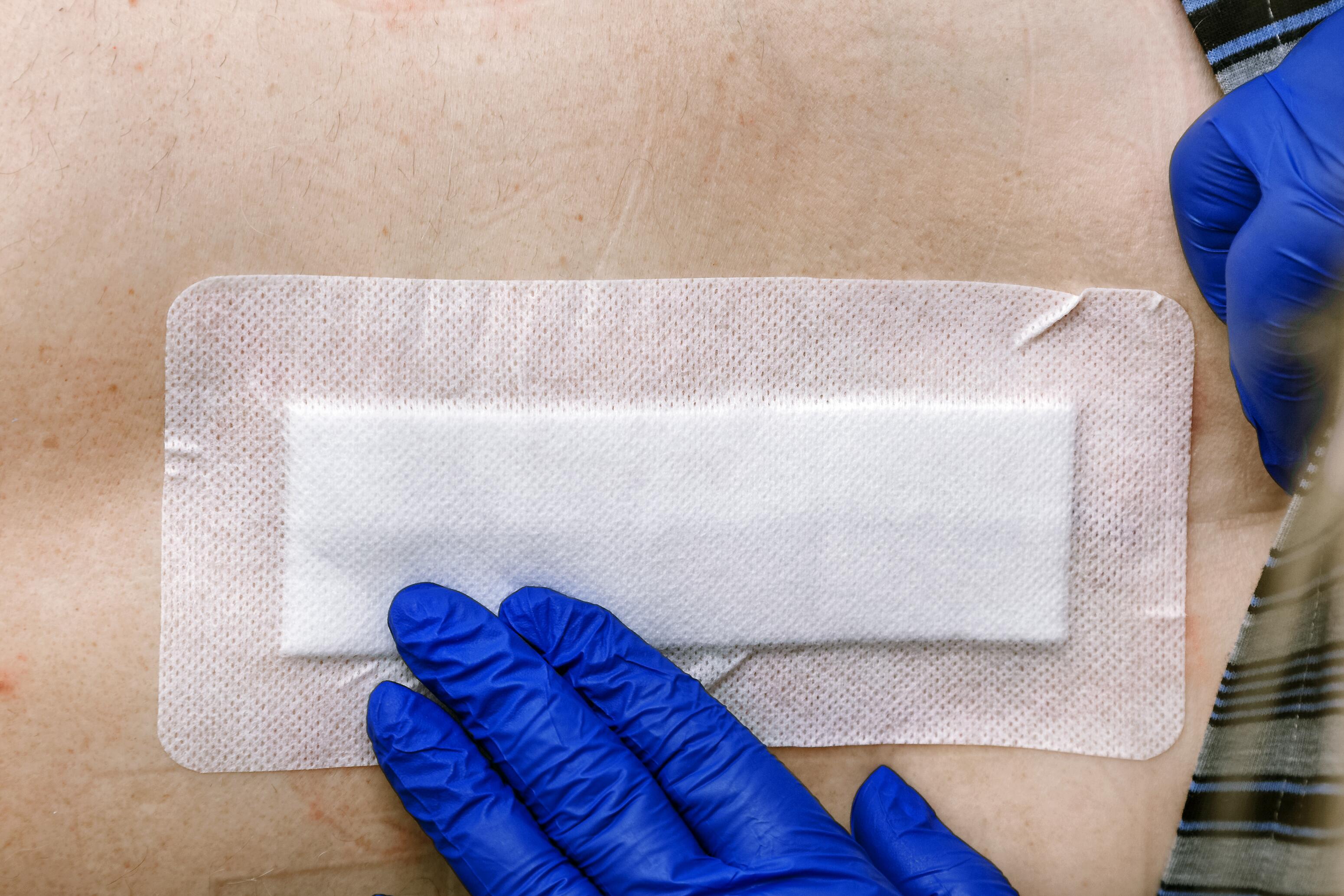 tipos de apósitos para tratar las heridas